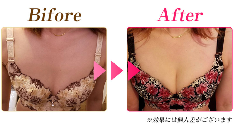 ビフォーアフター