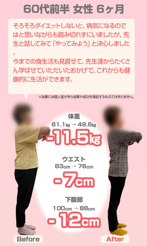 ビフォーアフター07