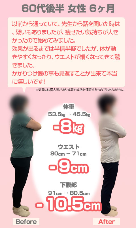 ビフォーアフター09