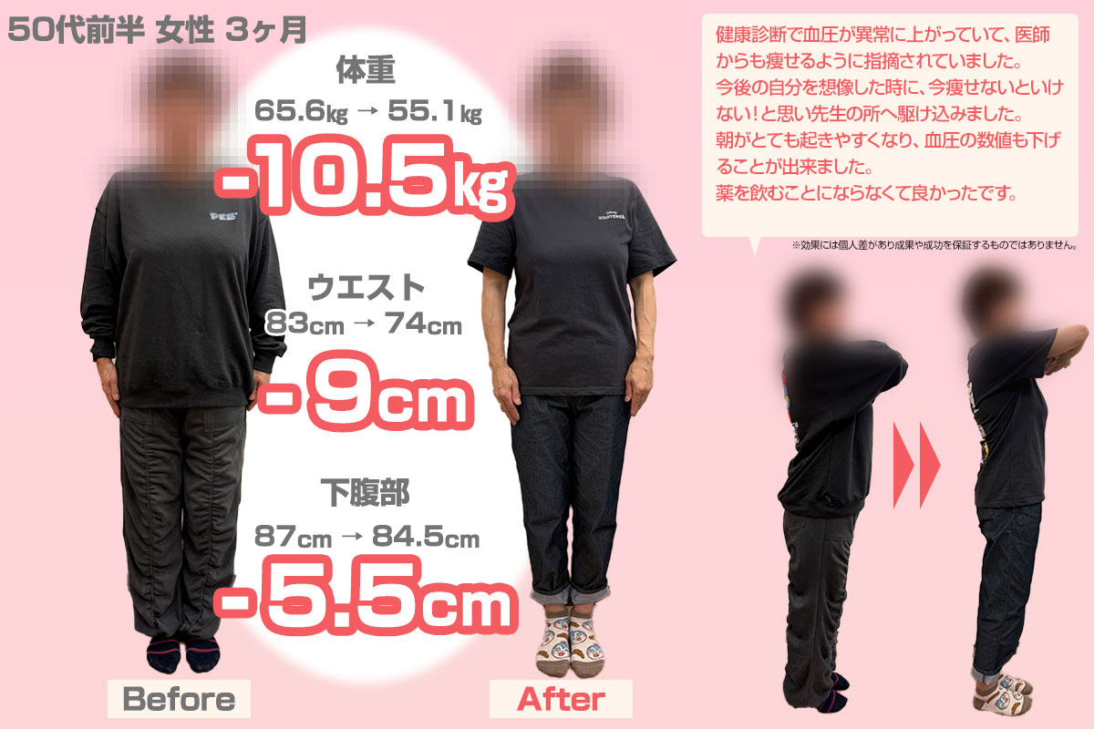 ビフォーアフター04