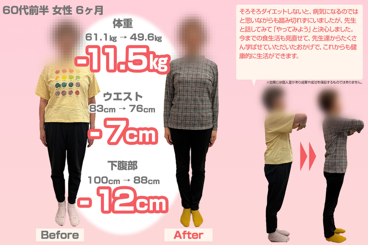 ビフォーアフター07