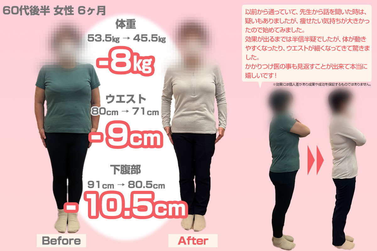 ビフォーアフター09