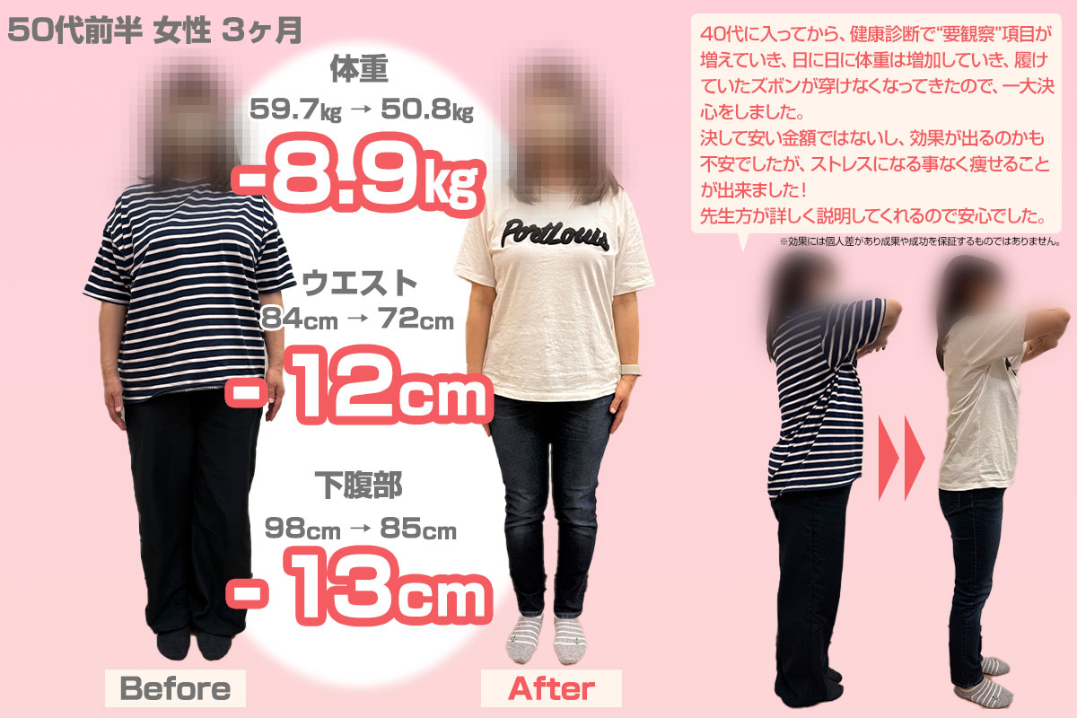 ビフォーアフター10