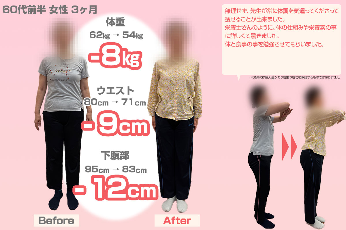 ビフォーアフター12