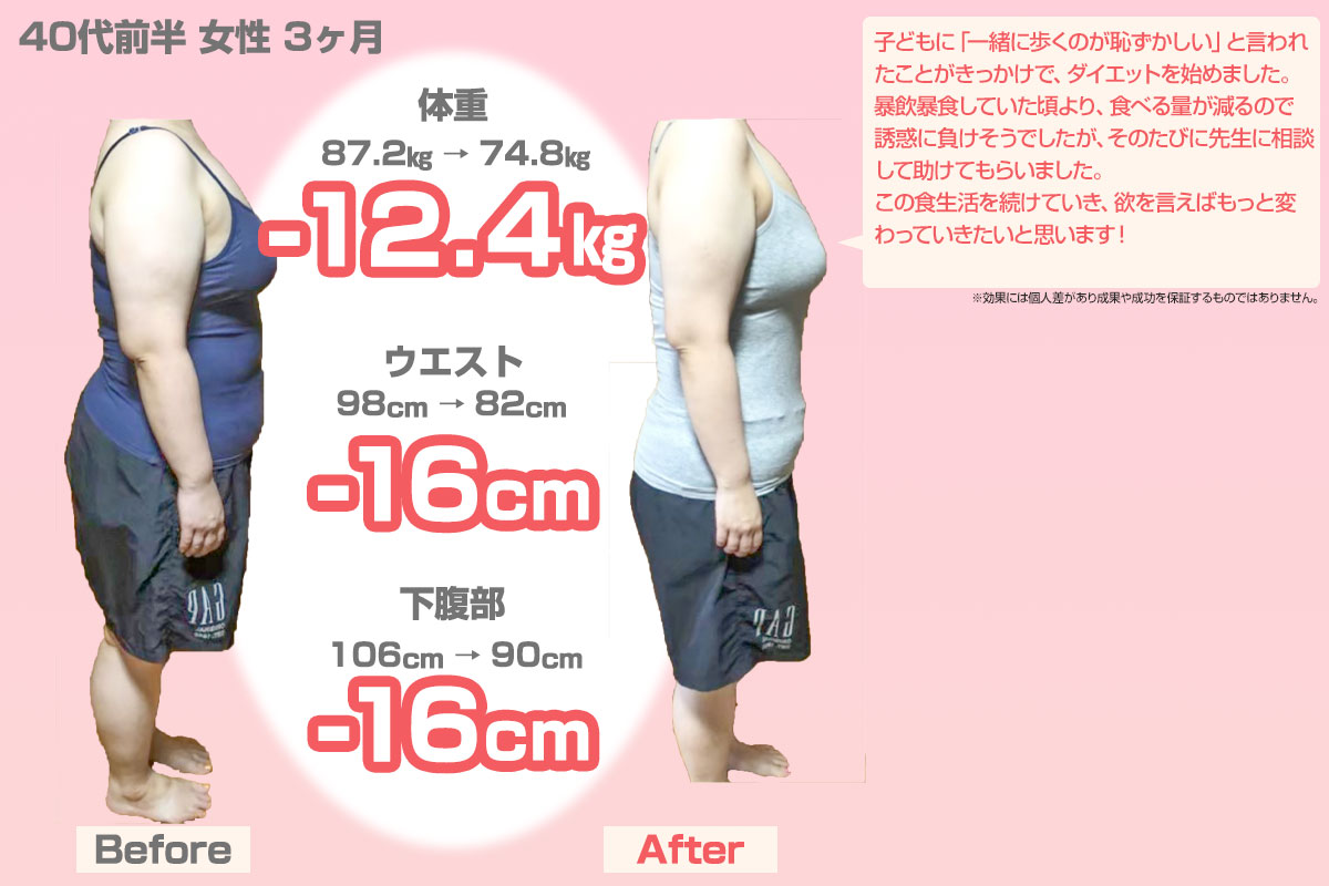 ビフォーアフター22