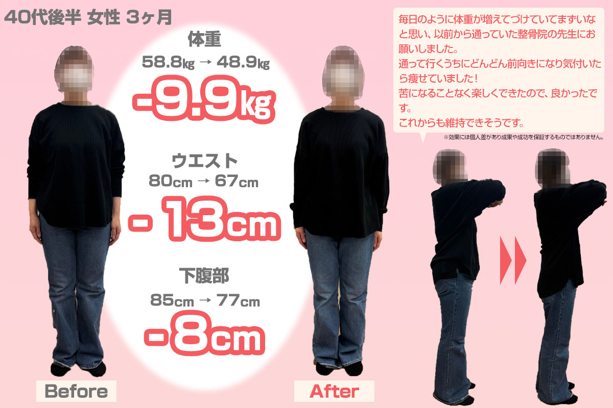 ビフォーアフター25